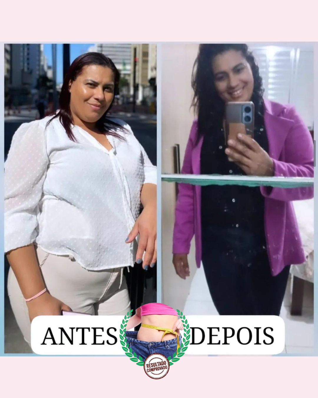 Antes e depois 5